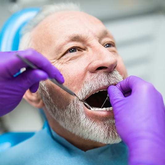 man having dentures worked on