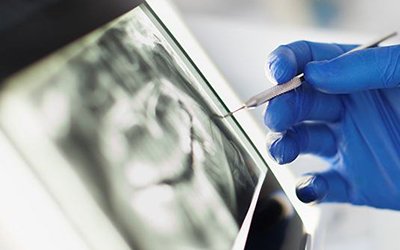 dentist looking at a patient’s X-rays