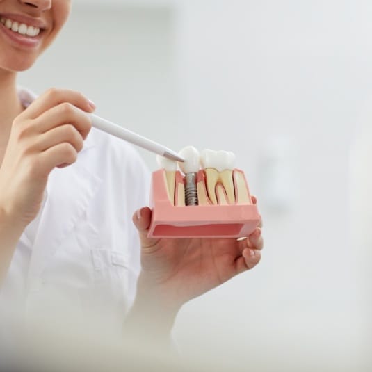 dentist showing a patient a model of how dental implants work 
