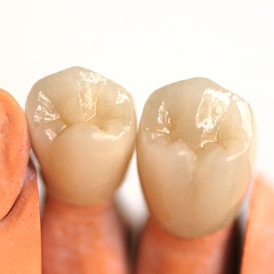 two dental crowns