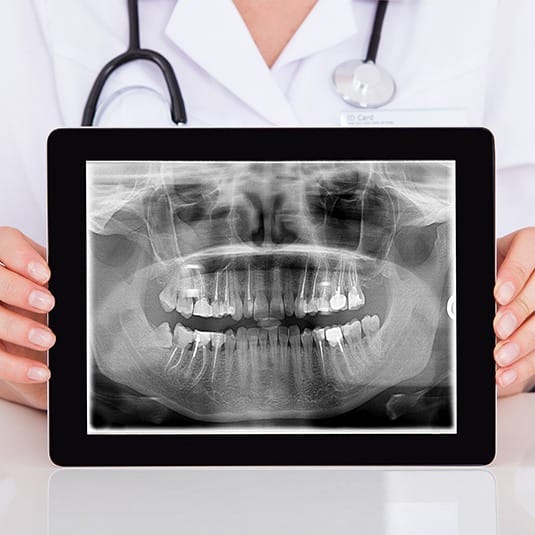 Digital x-ray on tablet