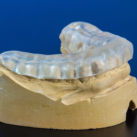 Occlusal Splints