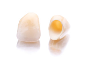 dental crowns