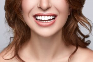 woman smiling with veneers